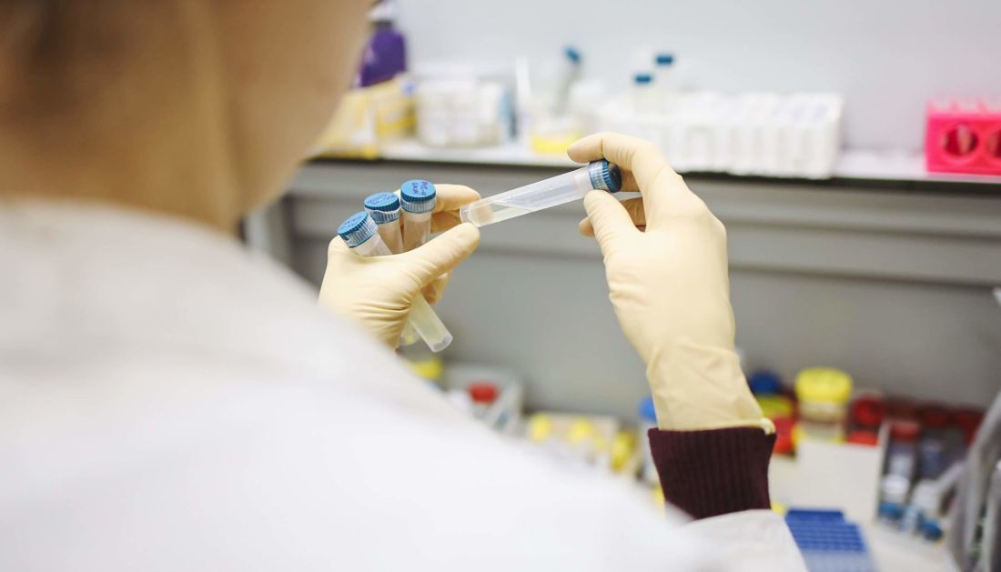 В Якутии за последние сутки выявлено 256 новых случаев коронавируса