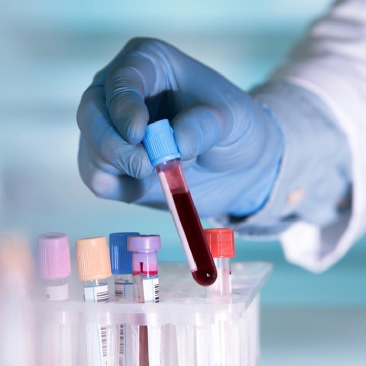 В Мегино-Кангаласском районе за сутки выявили 4 случая коронавируса