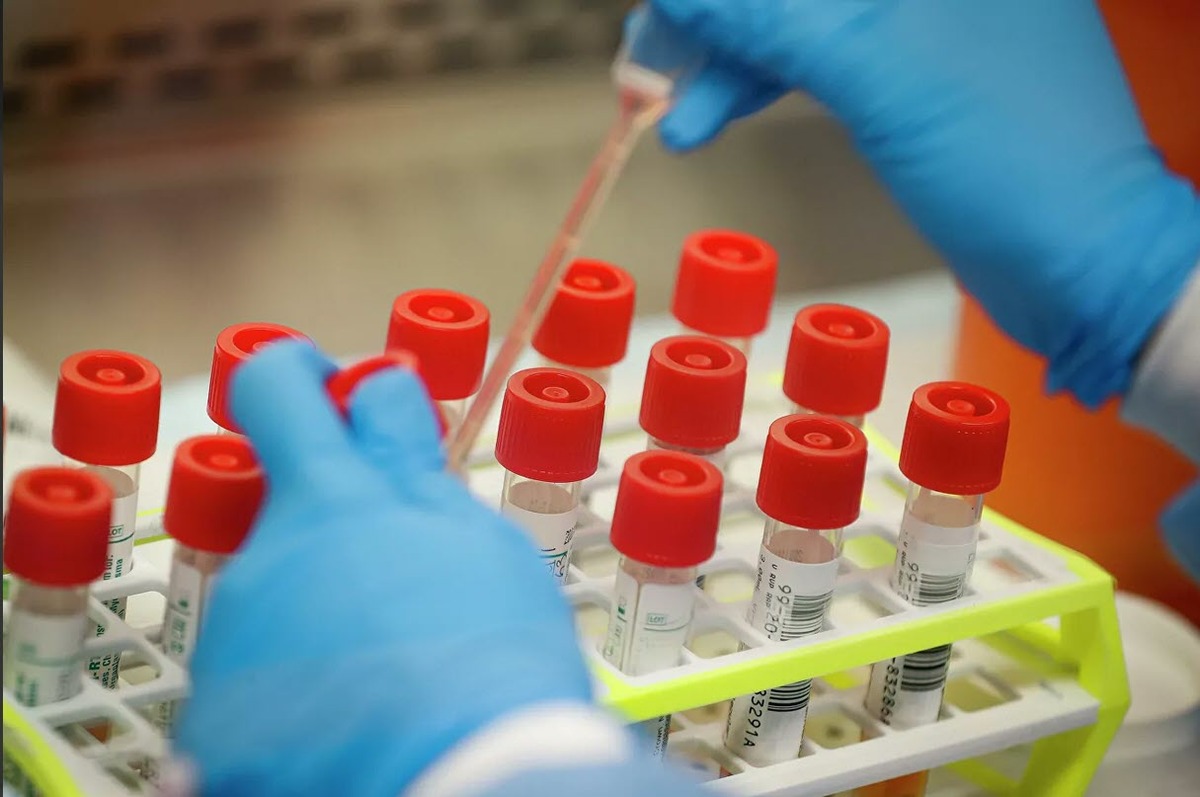 В Якутии за сутки выявлен 41 пациент с COVID-19 (на 18 мая)