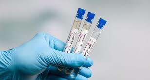 Четверо больных коронавирусом скончались в Якутии