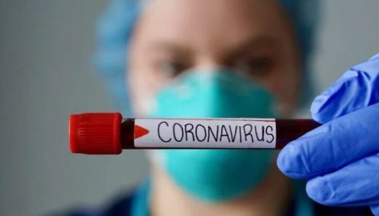 В Якутии за сутки выявлено 65 новых случаев коронавирусной инфекции