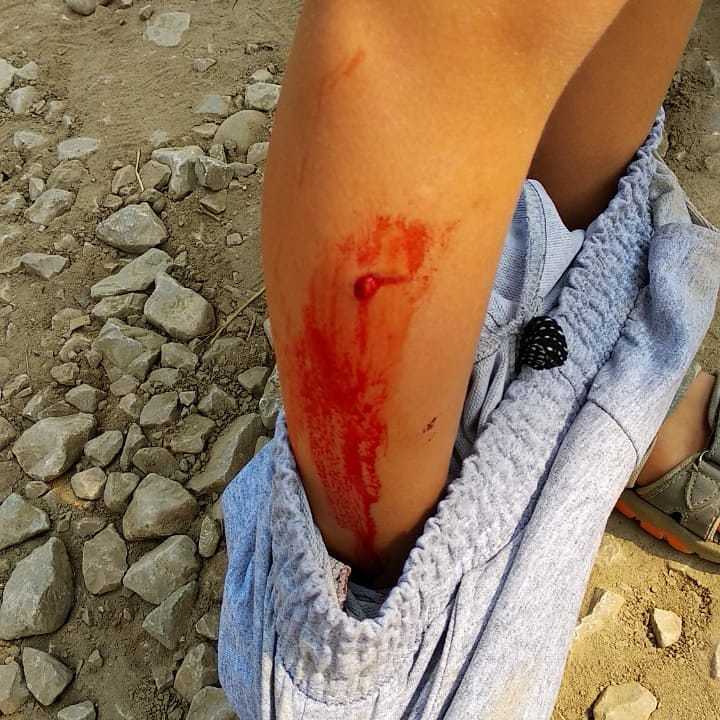 Видеофакт: В Якутске собаки искусали ребенка