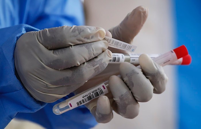 За сутки в Якутии коронавирусом заболели 176 человек