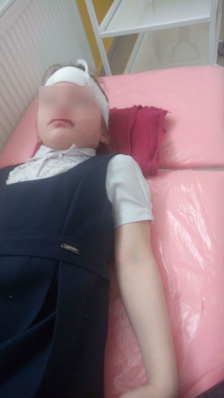 «Медицинскую помощь оказали учителя, а не медики». В Якутске девочка рассекла лоб во время падения в школе