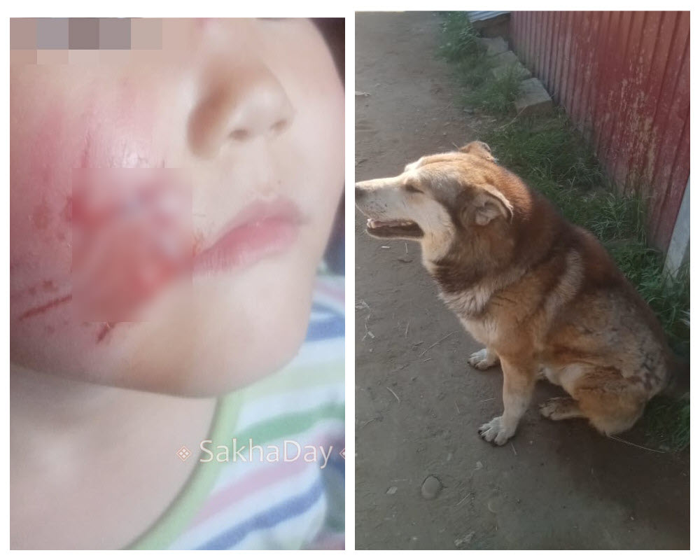 "Полщеки в клочья". В Якутске собака укусила 5-летнюю девочке за лицо