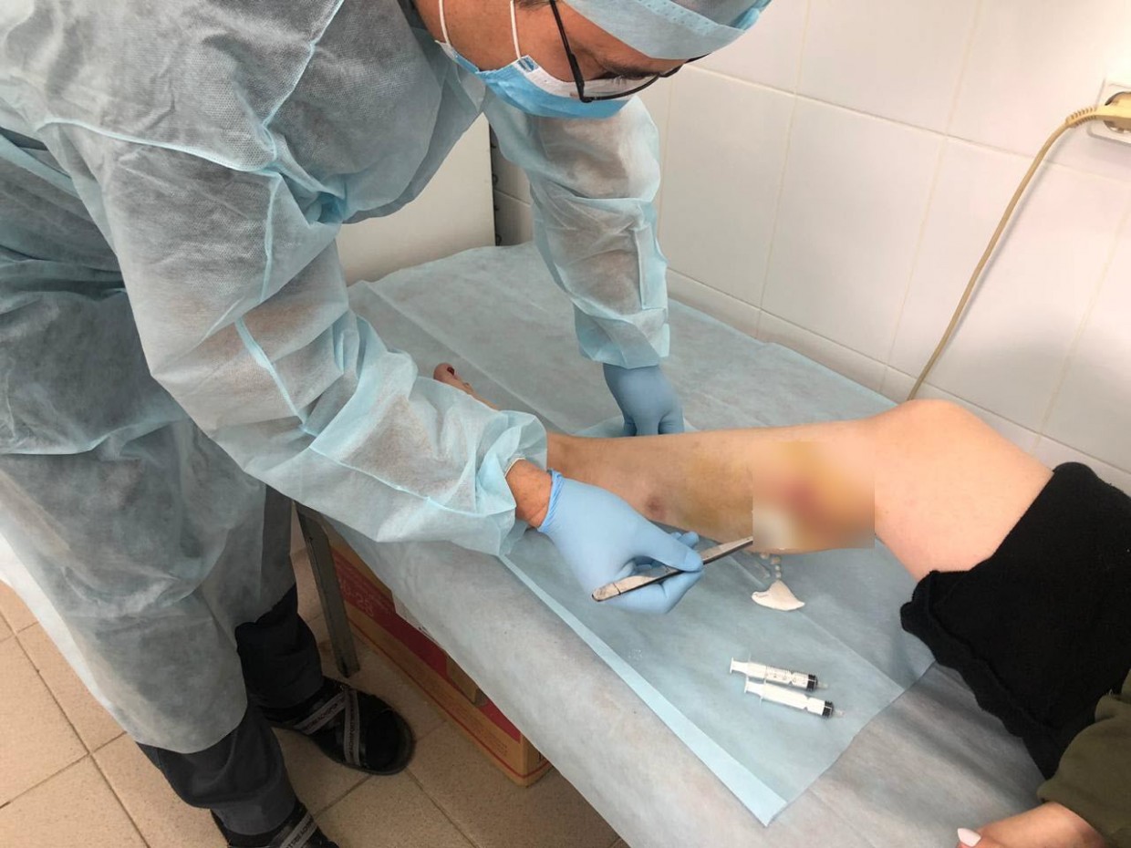 В этом году в Якутске от укусов собак пострадали 485 человек