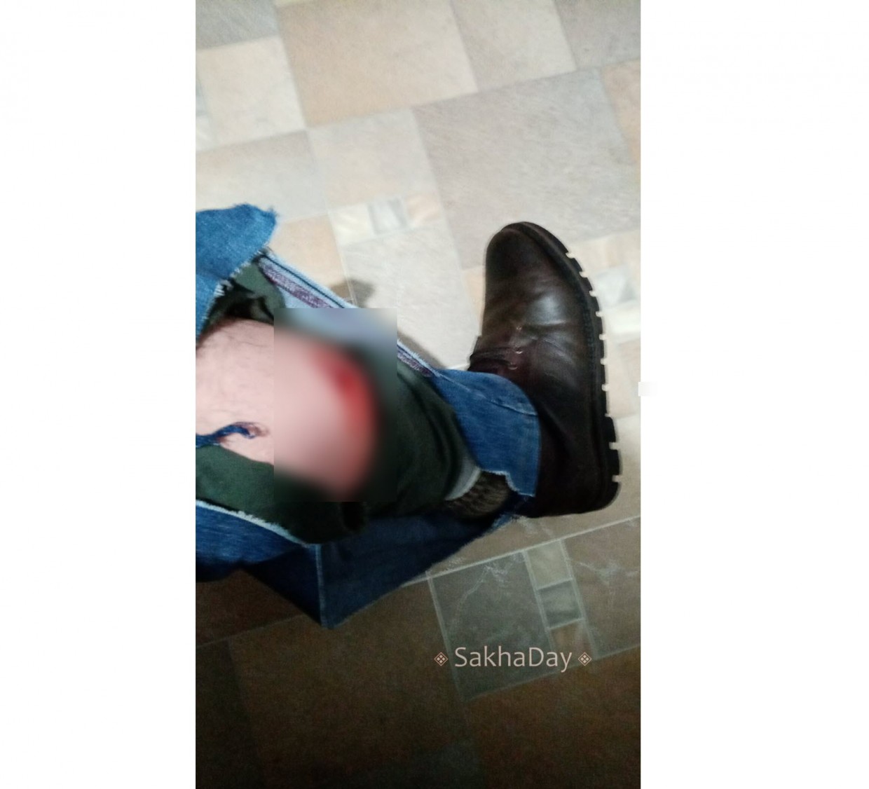 В Якутске стая собак набросилась на мужчину. Одну ему пришлось задушить