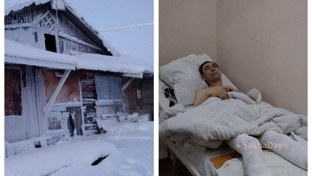 В Чокурдахе инвалид отморозил ноги в собственном доме