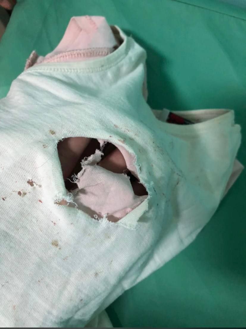 В Вилюйске на 4-летнюю девочку напала стая собак