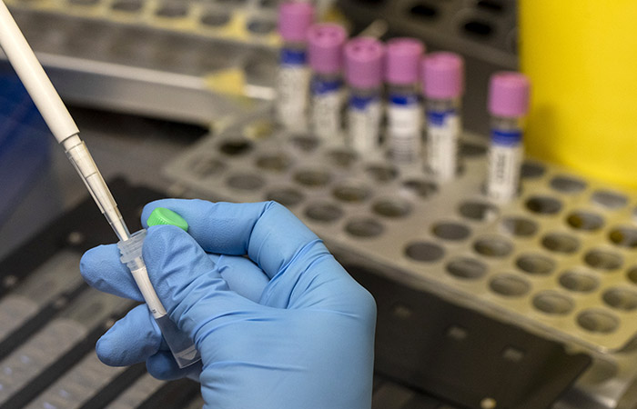 В России выявлена оспа обезьян