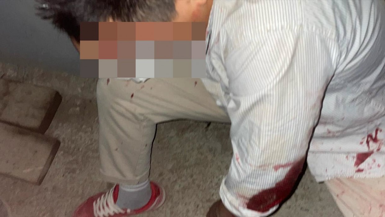 Компания, напавшая на молодую пару в Якутске, еще  не опознана