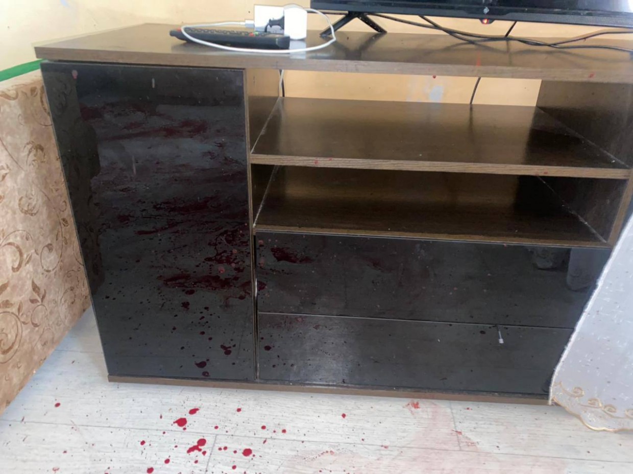 В Якутске мужчина изрезал лицо супруге и 5-летней дочери