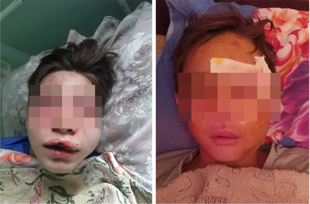 Якутянин, избивший подростков: заберите заявление, иначе мы напишем встречное