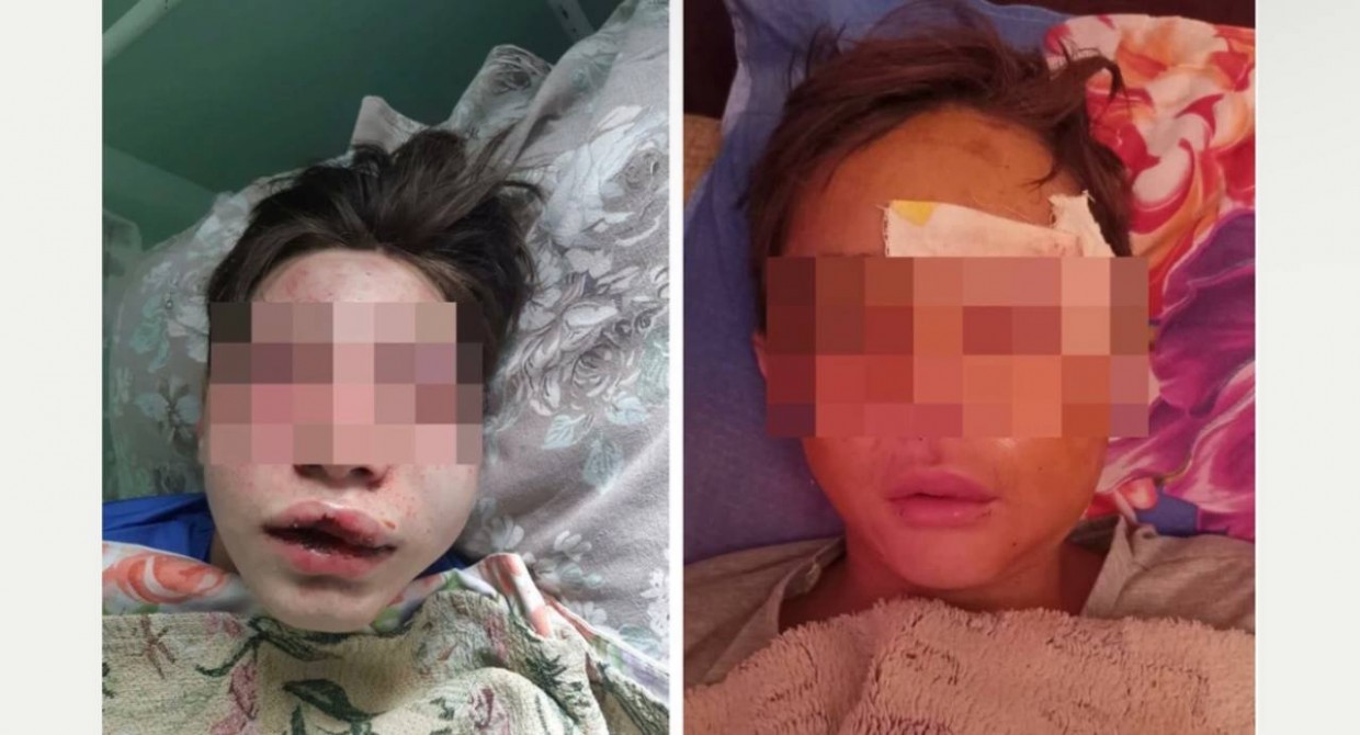 Прокуратура рассматривает дело о жестоко избитых мальчиках в Томпонском районе