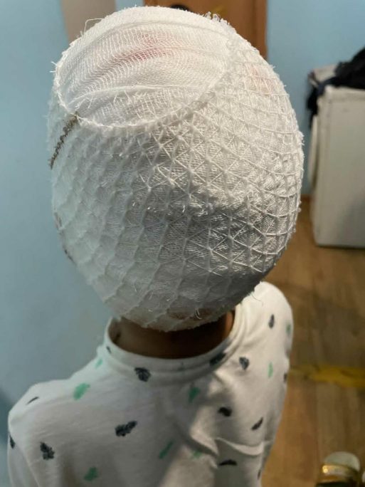 В Якутске прокуратура добивается компенсации в размере 300 тысяч рублей за нападение собаки