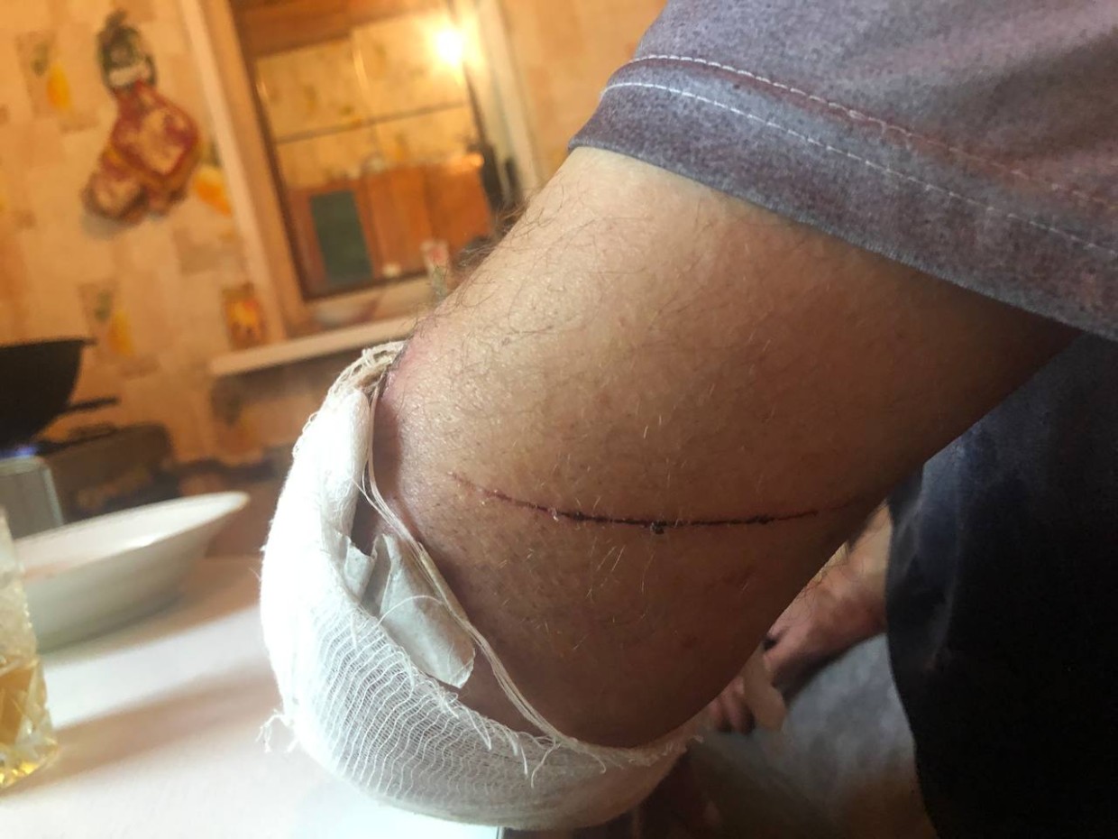 В Якутске гости избили хозяина дома за недожаренные шашлыки, но лишение свободы грозит не им