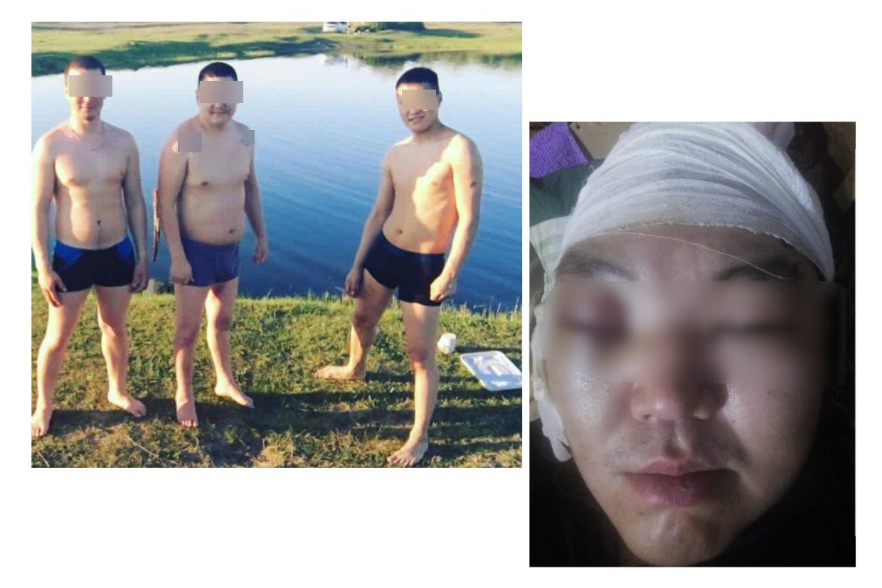 Усть-Янец, выколовший глаз шваброй, приговорен к реальному сроку в колонии