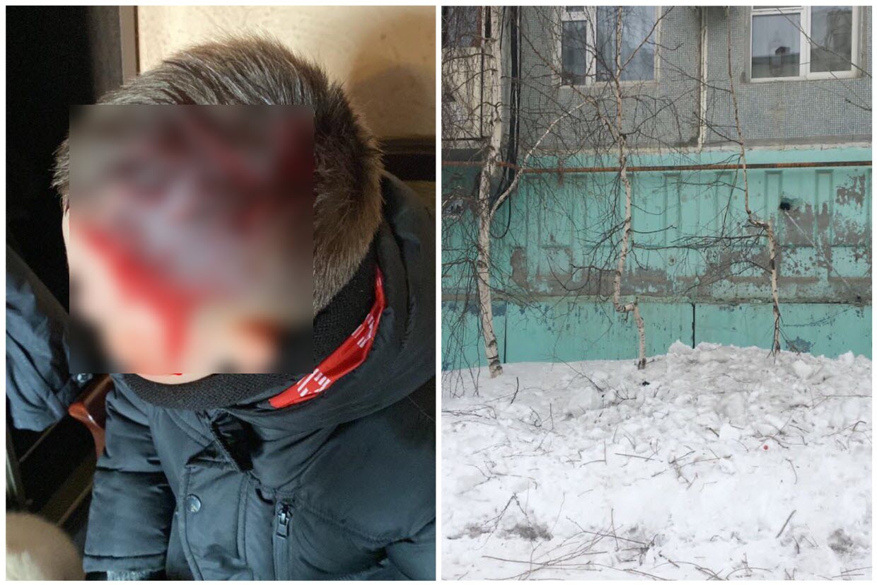 В Якутске ребенок получил рваную рану затылка. На него сбросил снег с крыши пьяный сантехник