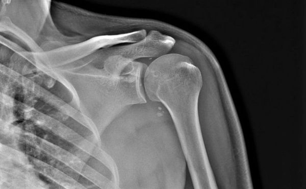 «Зато не навредили»: Житель Якутска взыскал с трех больниц 900 тысяч руб за причиненные страдания