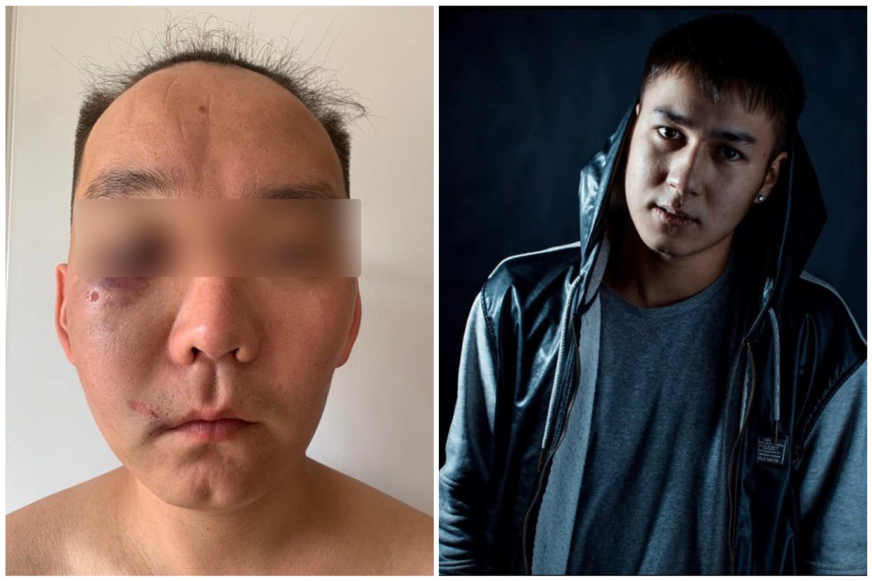 «Найдем и закопаем»: В Якутске певец Евгений Оленов и его друзья побили прохожего за внешний вид