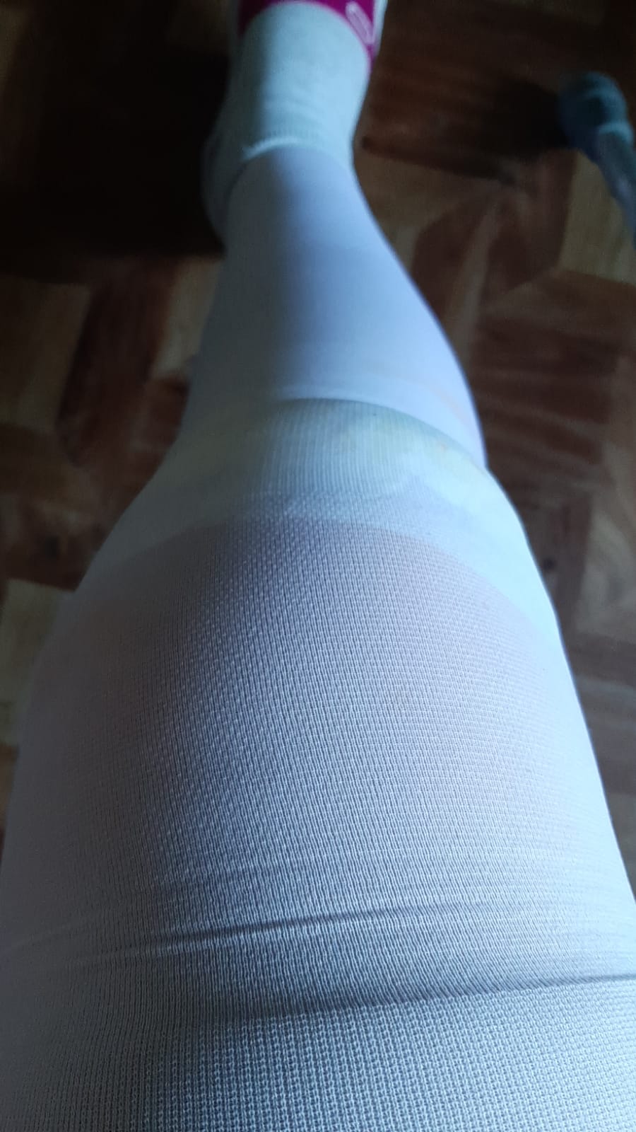 "Не могу же ползти к врачам на четвереньках". Жительница Якутска пожаловалась на невозможность добиться перевязки после операции