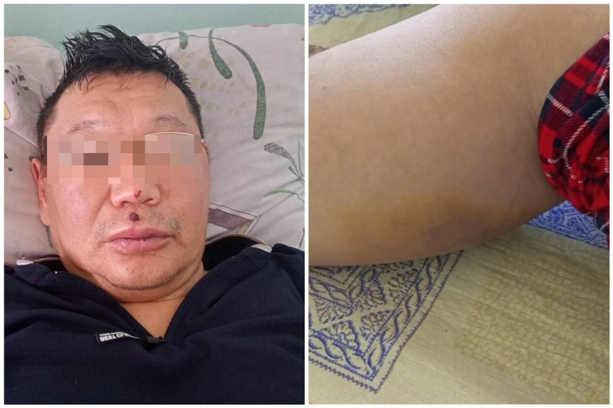 В Якутске завели уголовное дело по факту избиения на охоте в Хангаласском улусе