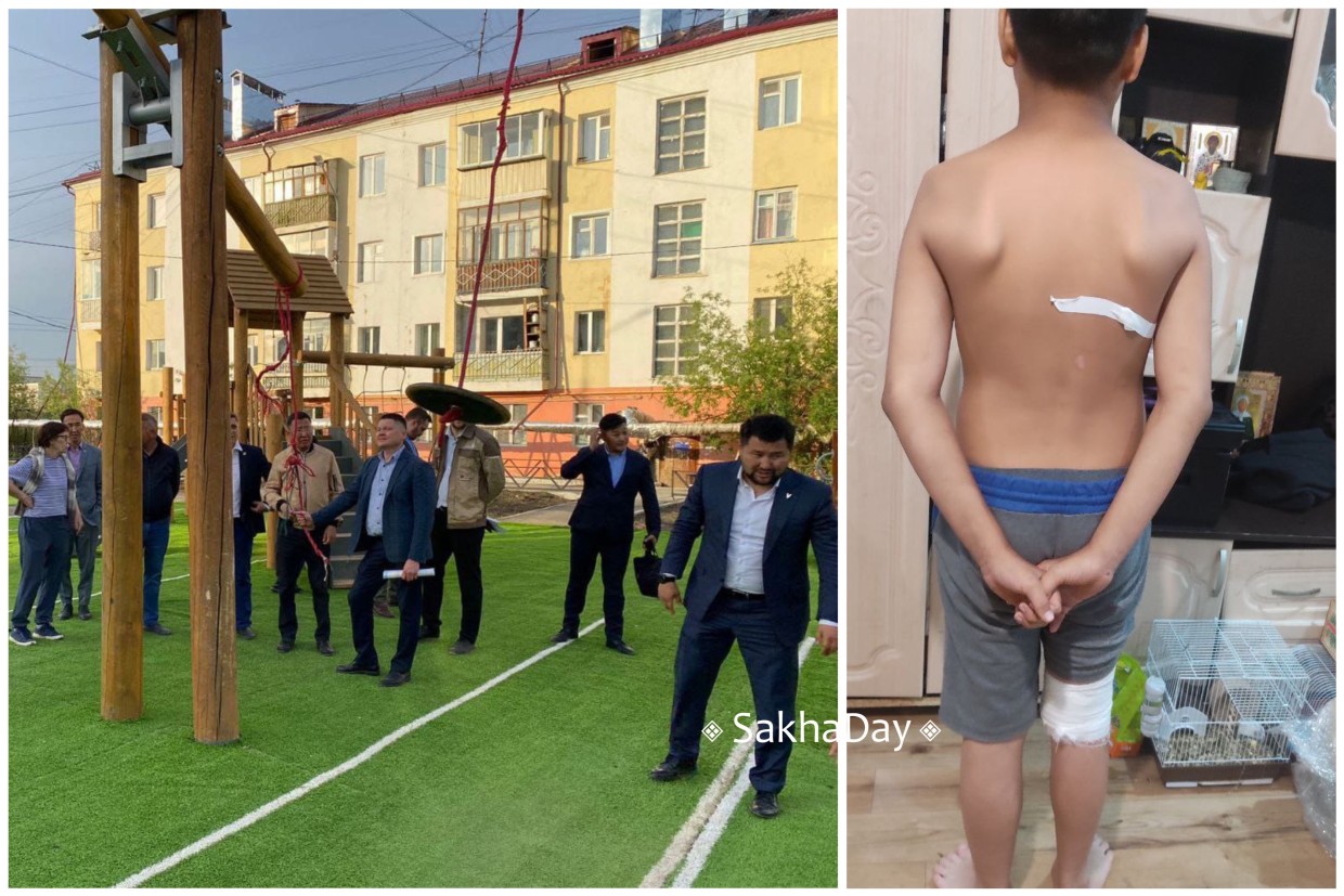 «Сын получил травму на турнике»: Печальный итог бездействия мэрии Якутска, подрядчика и УК