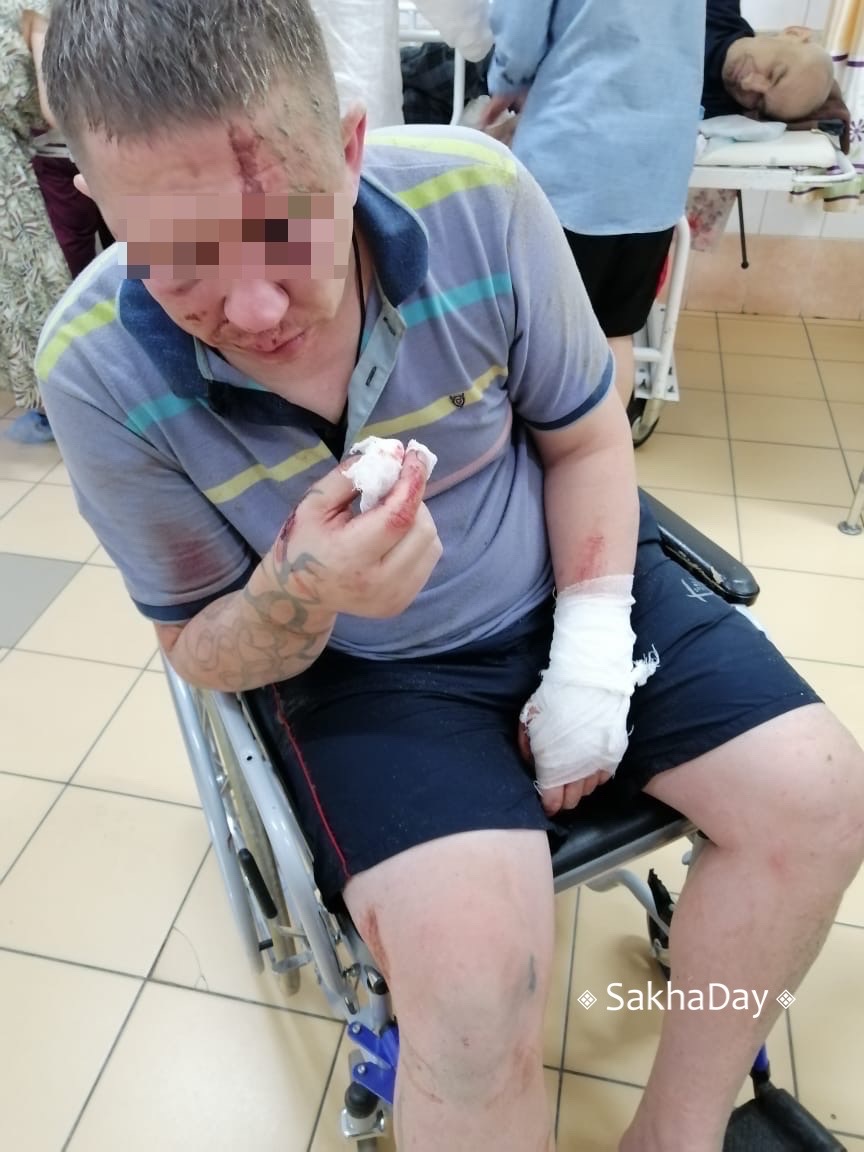 "Угрожал вывезти в лес": В Якутске после избиения у пострадавшего забрали телефон и хотели оформить кредит