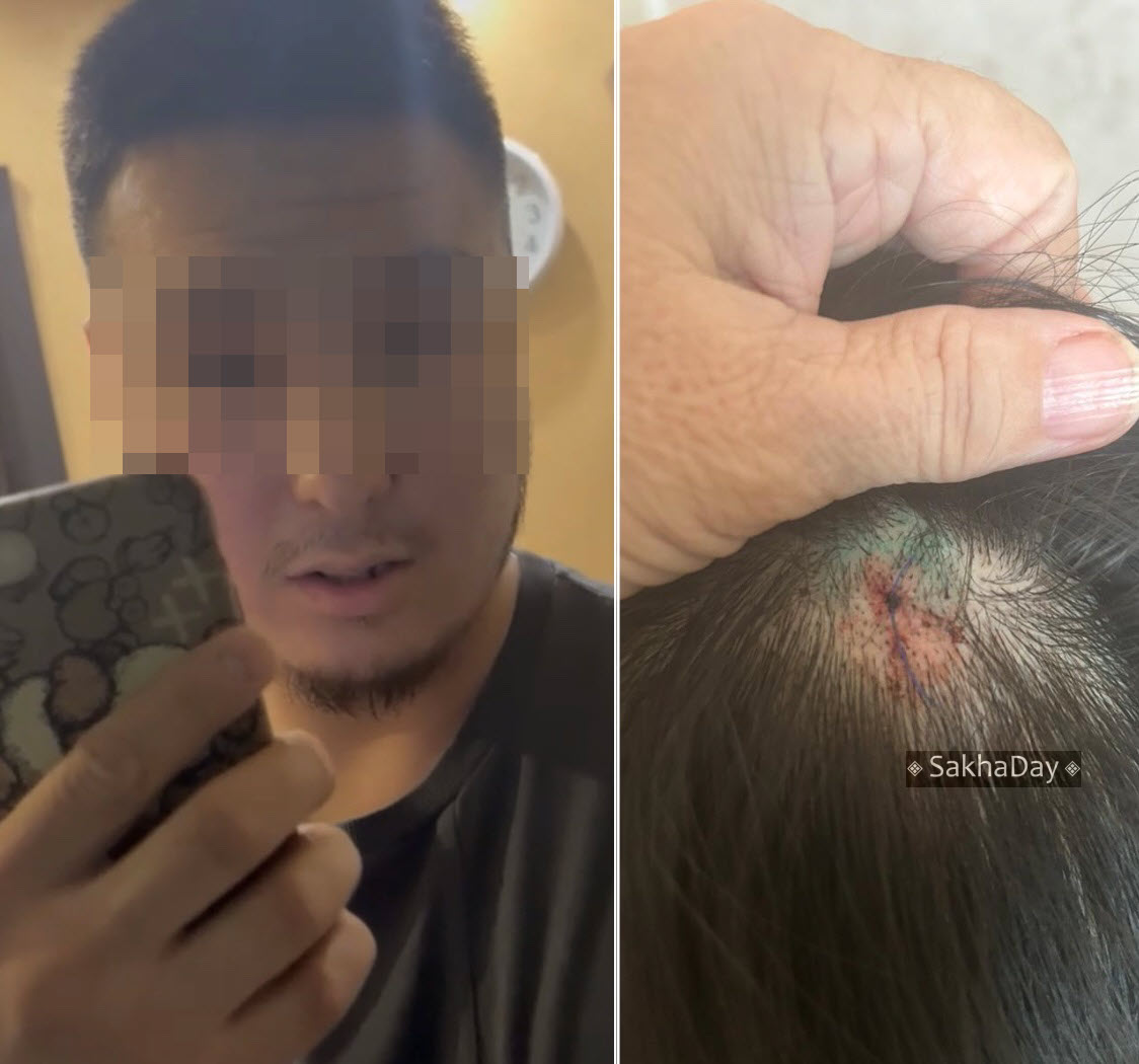 В Якутске мужчина ударил соседку головой об стену