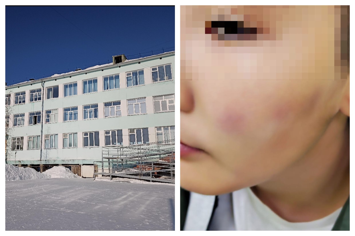 «Сыграем в Сушку?»: В Покровске полиция отказала в возбуждении административного дела, когда побили ребенка-инвалида