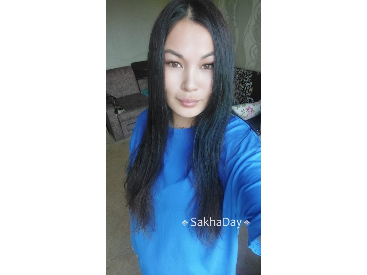 Анастасии Ивановой из Олекминска, которой муж отрезал ухо и нос, нужна ваша помощь