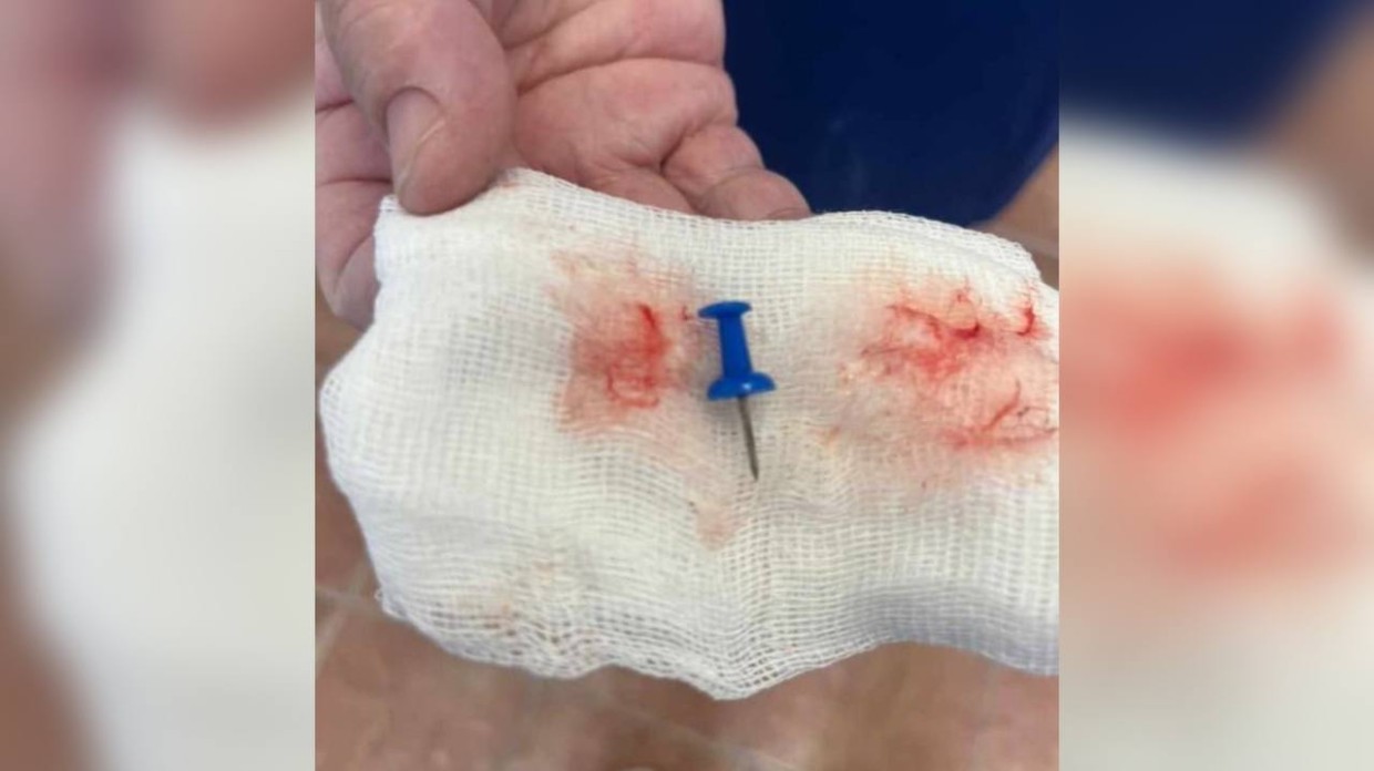 В селе Оленек подросток вдохнул канцелярский гвоздик. Спасать школьника прибыла санавиация