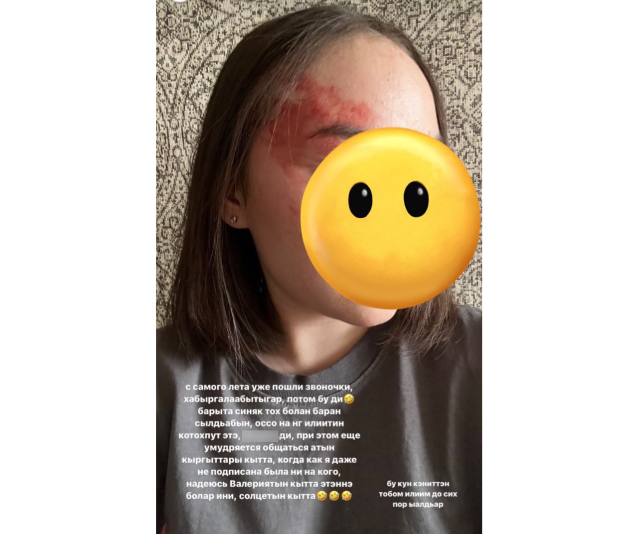 Якутянка заявила о том, что ее бил певец Семен А. В Якутии в майские выходные участились случаи домашнего насилия