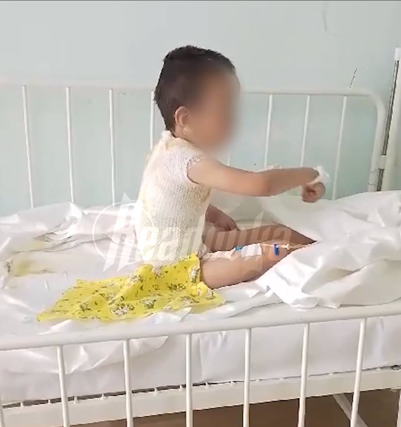 В Якутии родители пиромана отказываются полностью оплачивать лечение жертвы их сына