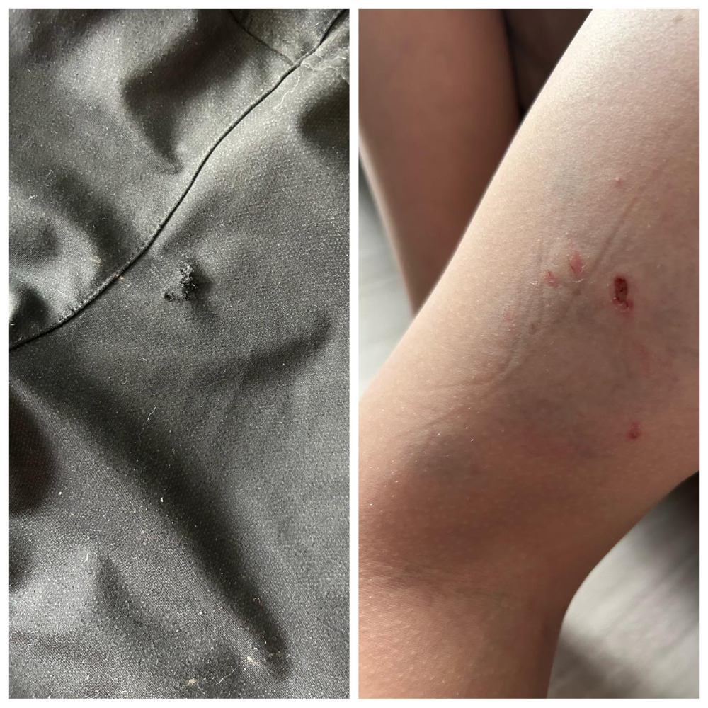 В Мархе овчарка искусала ребенка