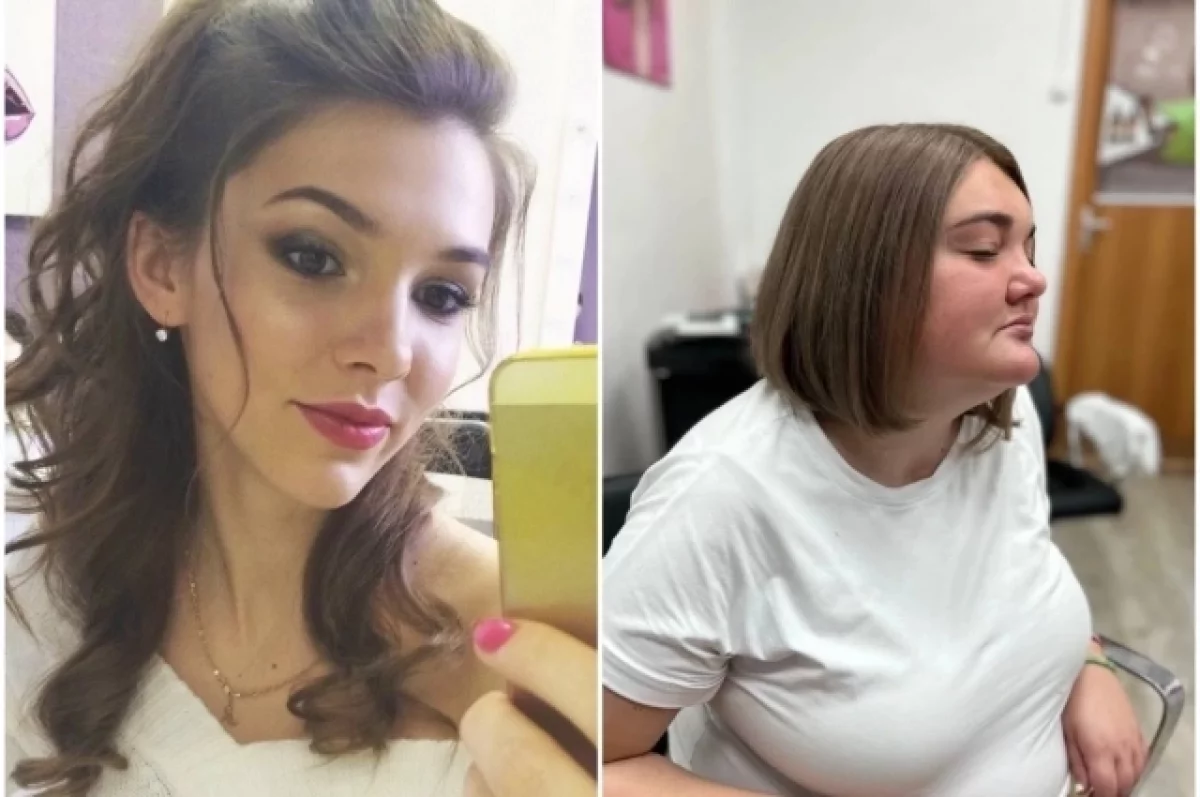 Изуродовал и бросил: как сейчас живет сибирская красавица Маша Лебедева — ослепшая, располневшая, потерявшая память