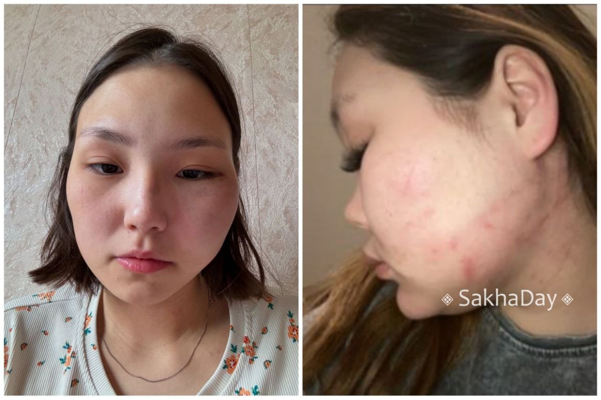 В Якутии мужчины осудили МЧСника и военного, избивавших своих девушек