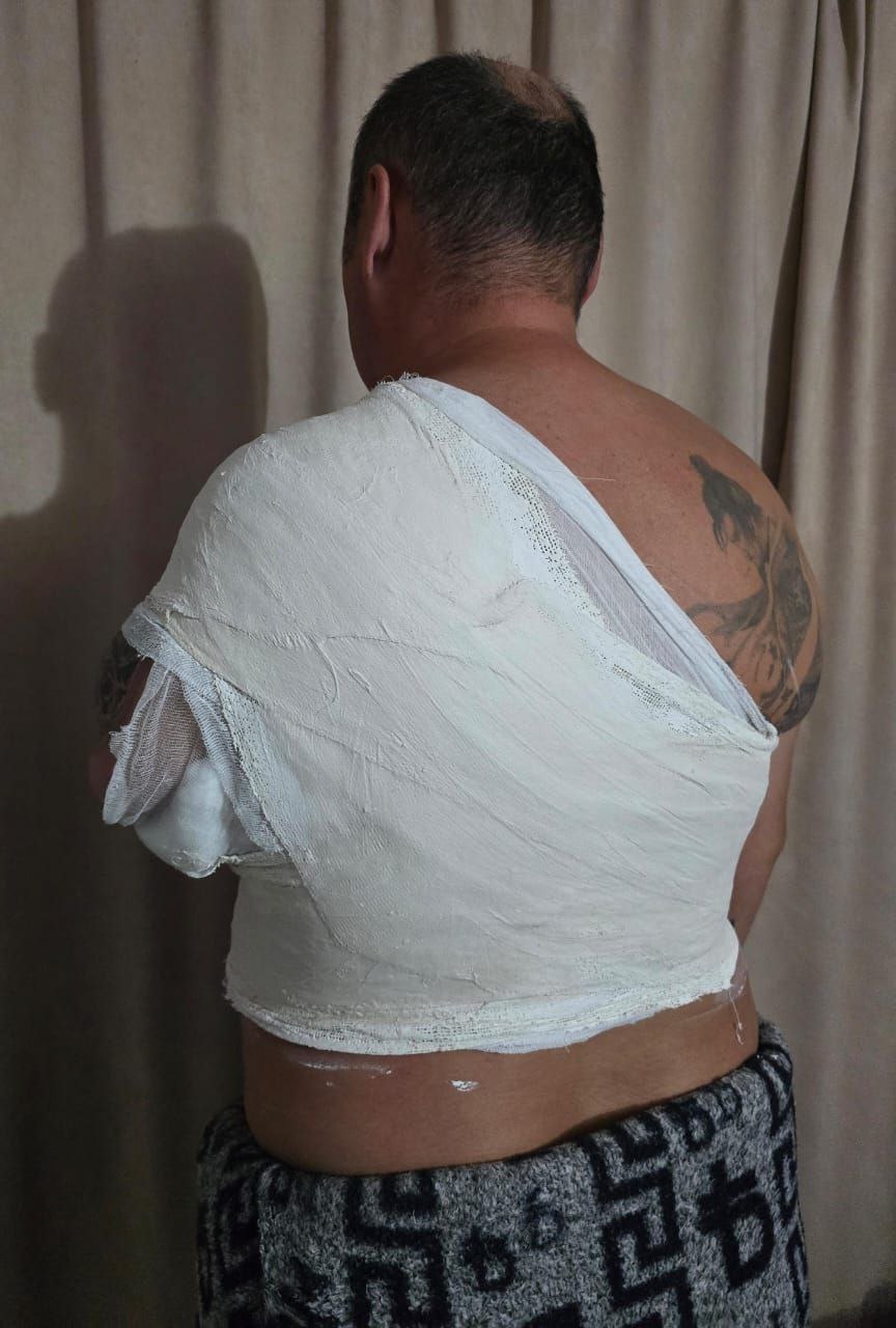 Мужчина, избивший участника СВО, выплатил компенсацию за моральный вред