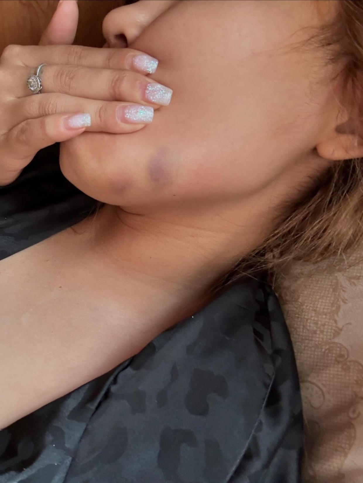 "Я сделаю из тебя инвалидку". В Якутске девушка рассказала о пережитом насилии и угрозах со стороны бывшего парня