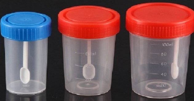 Контейнеры для анализов: три способа применить их дома — и ни один не про медицину