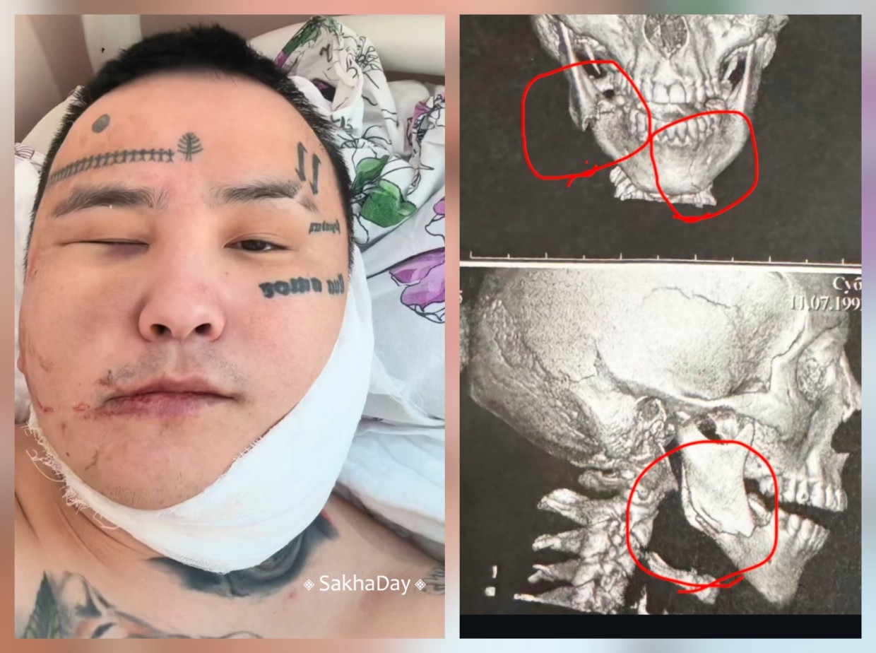 Якутского певца Kitjah пригласили выступить и жестоко избили