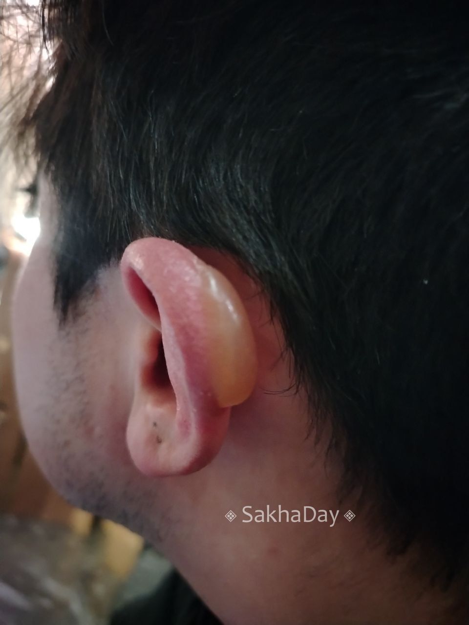 Фотофакт: Корейский экстремал отморозил в Якутии ухо