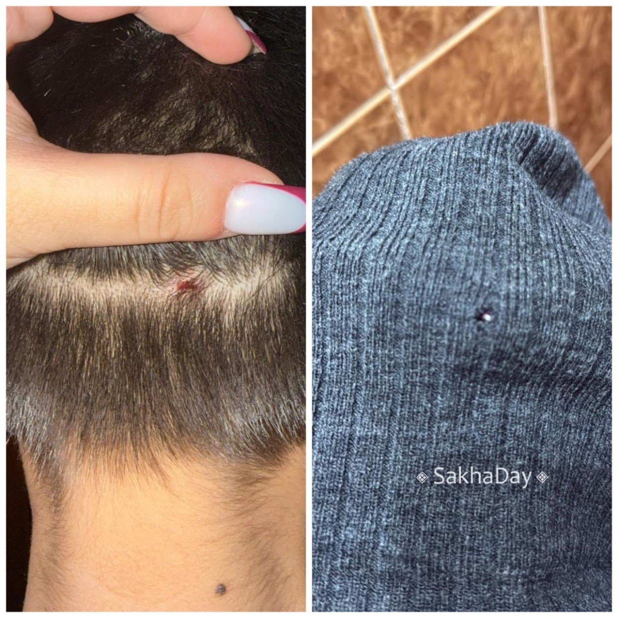 "Меня хотели убить!": В Якутске 8-летний мальчик напал с ножом на соседа